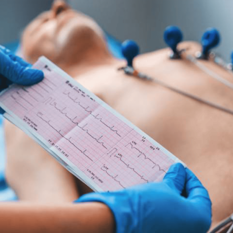 Electrocardiogram (ECG) Test in Ahmedabad